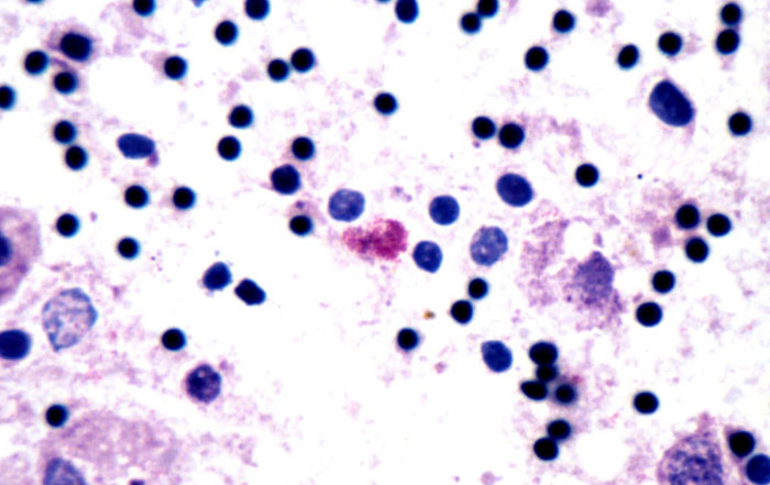 Chlamydophila psittaci